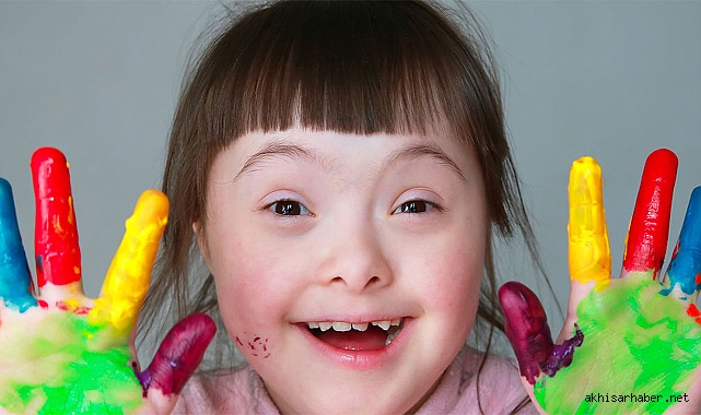 Gökyüzü Çocukları Derneğinden Down Sendromu Farkındalık Günü Mesajı