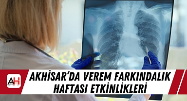 Akhisar’da Verem Farkındalık Haftası Etkinlikleri