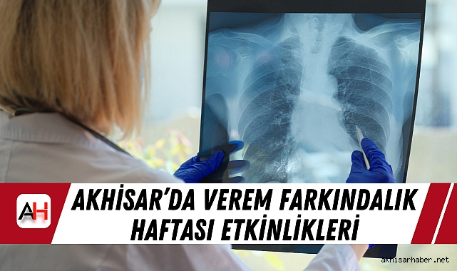 Akhisar’da Verem Farkındalık Haftası Etkinlikleri