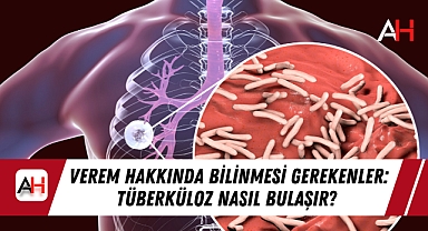 Verem Hakkında Bilinmesi Gerekenler: Tüberküloz Nasıl Bulaşır?