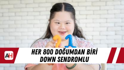 Her 800 doğumdan biri Down sendromlu